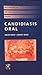 Referencia de bolsillo para candidiasis oral by David Wray