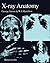 X-Ray Anatomy