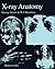 X-Ray Anatomy by George Simon