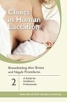 Breastfeeding aft...