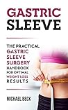 Gastric Sleeve: T...