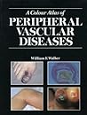 Colour Atlas of Peripheral Vascular Diseases