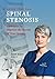 Rehab Your Own Spinal Stenosis: Strategies to Improve the Health of Your Spine