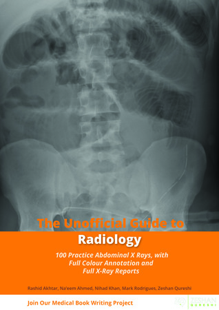 Unofficial Guide to Radiology: 100 Practice Abdominal X Rays with Full Colour Annotations and Full X Ray Reports (Unofficial Guides)