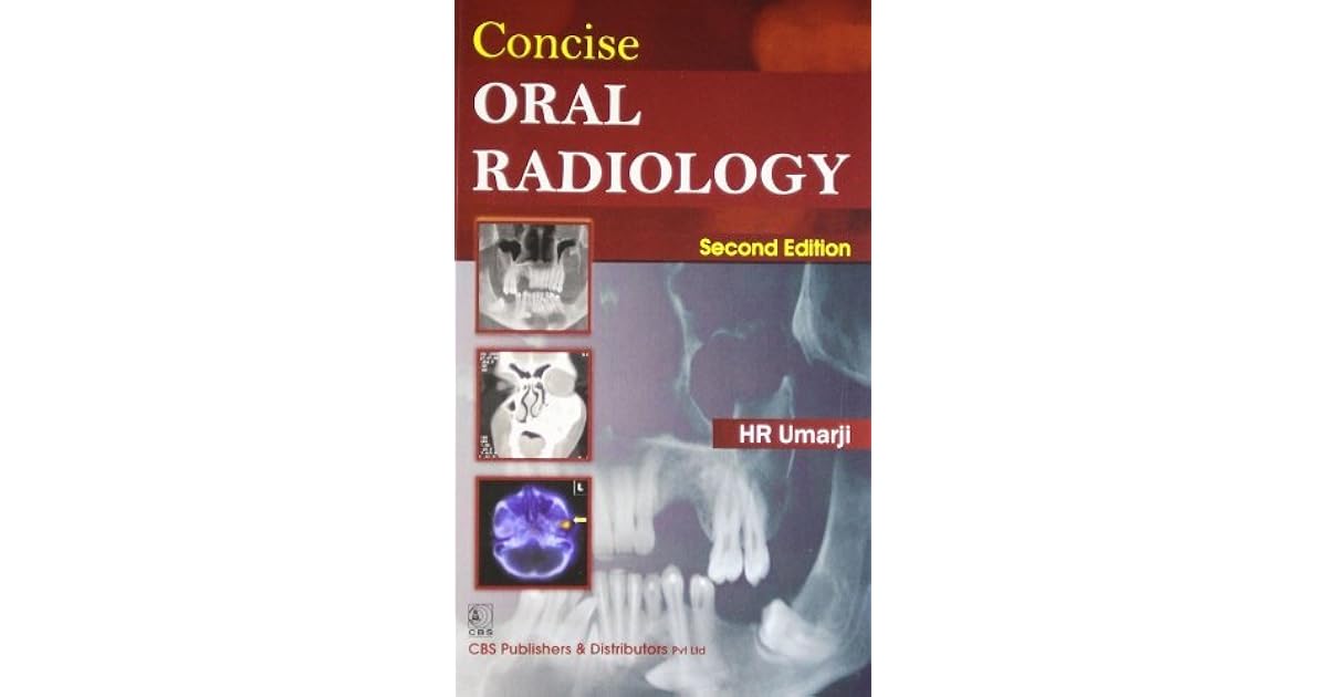 Concise Oral Radiology by H.R. Umarji