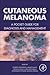 Cutaneous Melanoma: A Pocke...