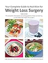 Your Complete Guide to Nutrition for Weight Loss Surgery
