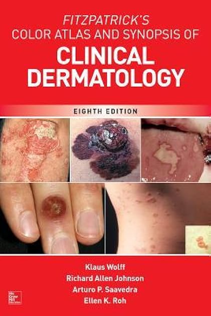 Fitzpatrick's Color Atlas and Synopsis of Clinical Dermatology