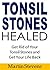 Tonsil Stones Healed: Get R...