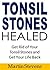 Tonsil Stones Healed by Martin Stevens