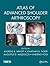 Atlas of Advanced Shoulder Arthroscopy