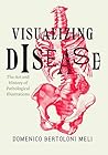 Visualizing Disea...