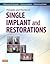 Principles and Practice of Single Implant and Restorations