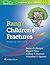Rang's Children's Fractures