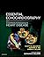Essential Echocardiography by Scott D. Solomon