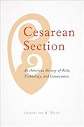 Cesarean Section: An American History of Risk, Technology, and Consequence