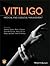 Vitiligo: Medical and Surgi...