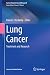 Lung Cancer by Karen L Reckamp Lung Cancer by Karen L Reckamp
