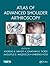 Atlas of Advanced Shoulder Arthroscopy