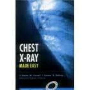 Chest X-Ray Made Easy (Paperback)
