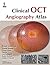 Clinical OCT Angiography Atlas