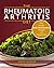 Rheumatoid Arthritis Diet -...