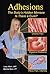 Adhesions: The Body's Hidde...