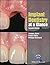 Implant Dentistry at a Glance (At a Glance (Dentistry))