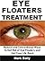 Eye Floaters Treatment: Nat...