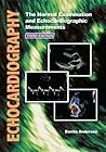 Echocardiography:...