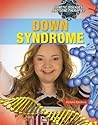 Down Syndrome (Genetic Diseases and Gene Therapies) Down Syndrome (Genetic Diseases and Gene Therapies)