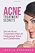Acne Treatment Secrets: Sec...