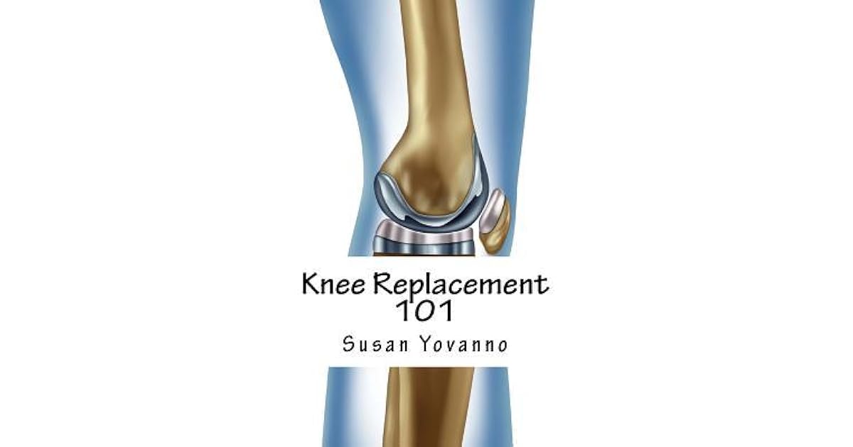 Knee Replacement 101 A User's Guide to Preparation for and Recovery