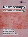 Dermoscopy in General Dermatology