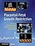 Placental-Fetal Growth Restriction by Christoph Lees