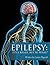 Epilepsy: It’s a Killer, bu...