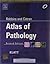 Robbins and Cotran Atlas of Pathology