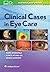 Clinical Cases in Eye Care