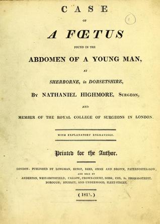Case of a Foetus Found in the Abdomen of a Young Man: At Sherborne, in Dorsetshire (Paperback)