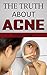 The Truth About Acne