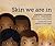 Skin We are In by Sindiwe Magona