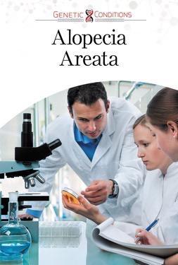 Alopecia Areata (Genetic Conditions)