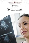 Down Syndrome