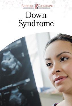 Down Syndrome (Genetic Conditions)