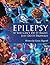 Epilepsy: If You Can’T Do I...