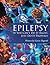 Epilepsy by Gavin Hogarth