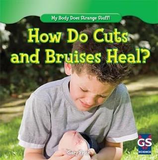 How Do Cuts and Bruises Heal? (My Body Does Strange Stuff!)