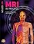 MRI in Practice by Catherine Westbrook