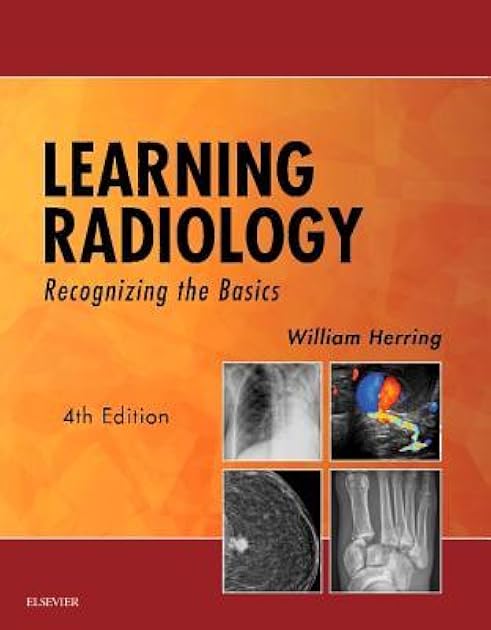 Learning Radiology: Recognizing the Basics