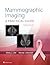 Mammographic Imaging